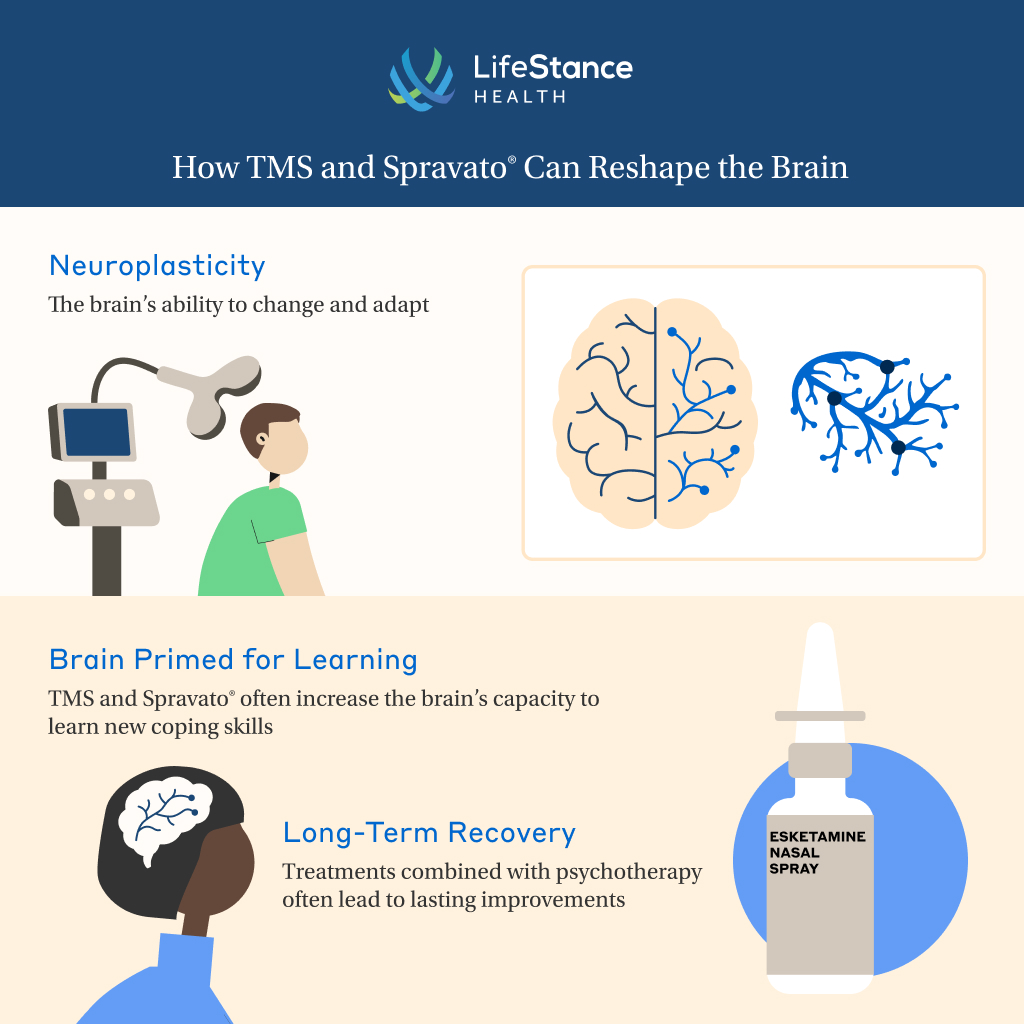 tms-spravato-neuroplasticity